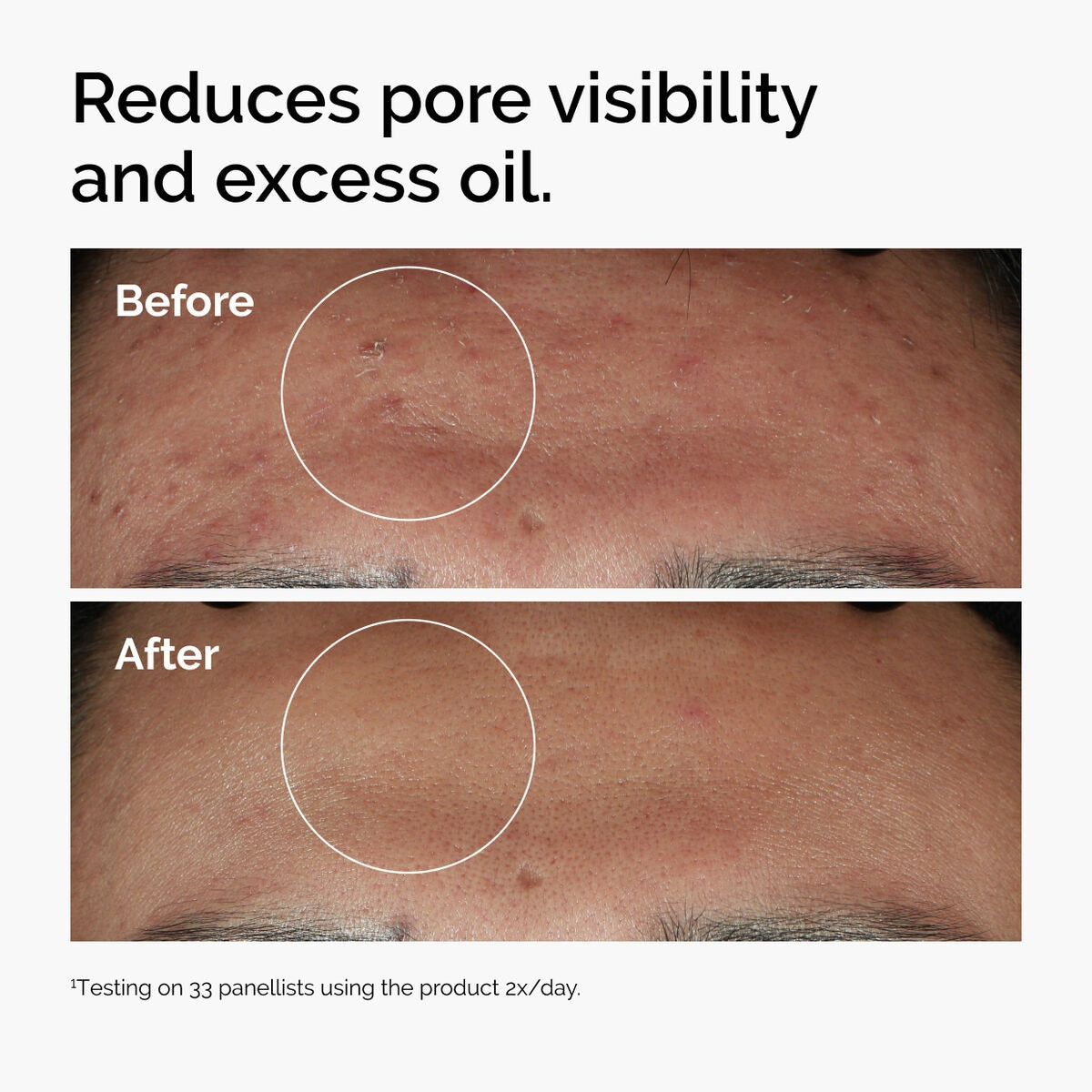 The Ordinary Niacinamide 10% + Zinc 1% - 30ml
